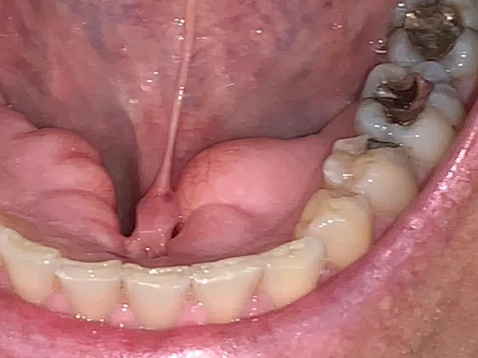 Cirugía oral: antes del tratamiento