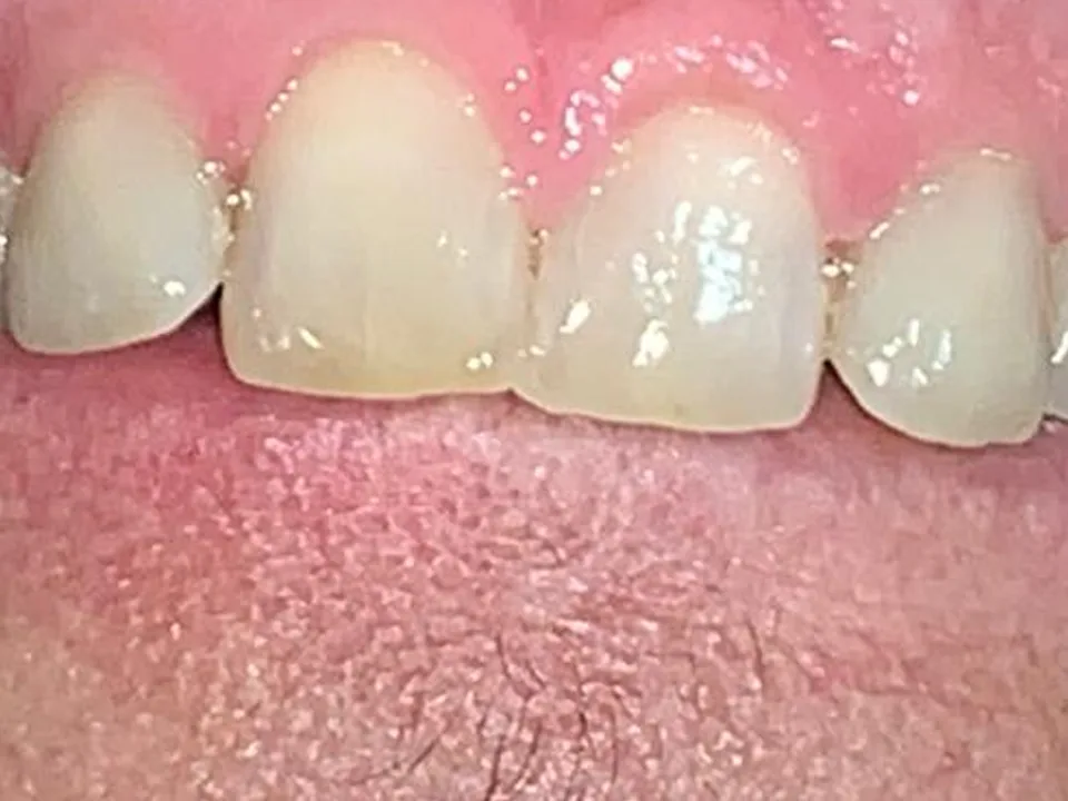 Cirugía oral: antes del tratamiento